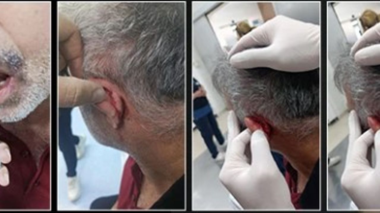 Gaziantep’te Hastane Personeline Röntgen Odasında Saldırı